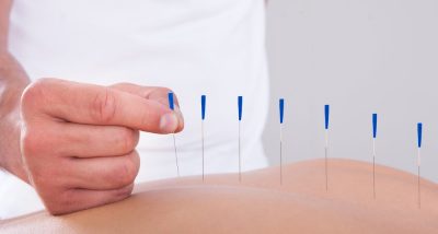 Acupuncture Cost Guide